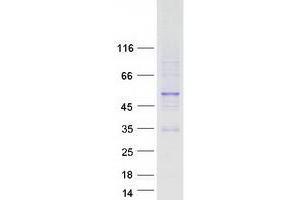 Validation with Western Blot