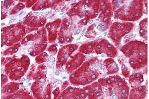 Human Pancreas: Formalin-Fixed, Paraffin-Embedded (FFPE)