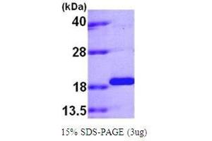 Figure annotation denotes ug of protein loaded and % gel used.