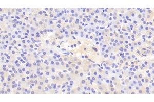 Detection of IREB2 in Human Kidney Tissue using Polyclonal Antibody to Iron Responsive Element Binding Protein 2 (IREB2)