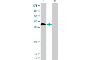 Western Blot analysis of HOXA11 expression in transfected 293T cell line by HOXA11 monoclonal antibody (M01), clone 7E12.