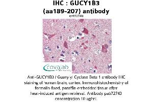 Image no. 2 for anti-Guanylate Cyclase 1, Soluble, beta 3 (GUCY1B3) (AA 189-207) antibody (ABIN2852385) (GUCY1B3 anticorps  (AA 189-207))