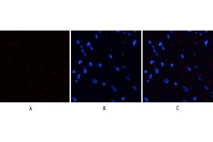 Immunofluorescence analysis of rat heart tissue. (PERK anticorps  (pThr981))