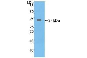 Detection of Recombinant DMD, Human using Polyclonal Antibody to Dystrophin (DMD) (Dystrophin anticorps  (AA 3048-3328))