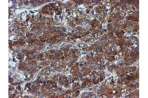 Image no. 7 for anti-Iduronate 2-Sulfatase (IDS) antibody (ABIN1498797)