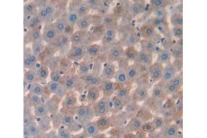 Used in DAB staining on fromalin fixed paraffin- embedded liver tissue