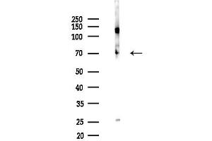 anti-Succinate Dehydrogenase Complex, Subunit A, Flavoprotein (Fp) (SDHA) (Internal Region) antibody