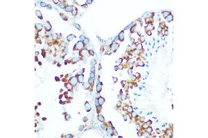 Immunohistochemistry of paraffin-embedded mouse testis using STIP1 Rabbit pAb (ABIN6133089, ABIN6148592, ABIN6148593 and ABIN6218351) at dilution of 1:100 (40x lens).