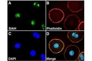 Immunofluorescence staining of SIAH2 on NIH : OVCAR-3 with SIAH2 monoclonal antibody, clone 24E6H3 .