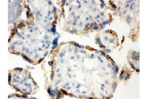 IHC analysis of ERp57 using anti-ERp57 antibody .