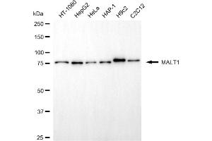 anti-Mucosa Associated Lymphoid Tissue Lymphoma Translocation Gene 1 (MALT1) antibody