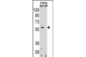 SD5 Antibody (Center) (ABIN1881816 and ABIN2838794) pre-incubated without(lane 1) and with(lane 2) blocking peptide in Hela cell line lysate. (SMAD5 anticorps  (AA 241-269))