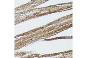 Immunohistochemistry of paraffin-embedded rat heart using SOCS3 Rabbit pAb (ABIN3021099, ABIN3021100, ABIN3021101 and ABIN6213950) at dilution of 1:50 (40x lens).