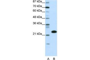 Western Blotting (WB) image for anti-TATA Box Binding Protein Associated Factor 11 (TAF11) antibody (ABIN2460381) (TAF11 anticorps)