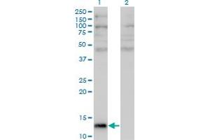 Western Blot analysis of ANG expression in transfected 293T cell line by ANG monoclonal antibody (M05), clone 2A7. (ANG anticorps  (AA 25-147))