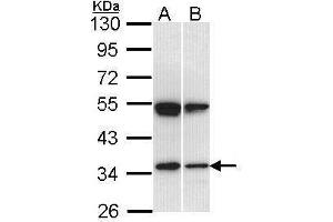WB Image Sample (30 ug of whole cell lysate) A: Hep G2 , B: Raji 10% SDS PAGE antibody diluted at 1:1000 (SH3GL1 anticorps  (Center))