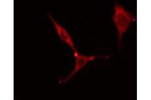 ABIN6275782 staining Hela cells by IF/ICC. (MYL6 anticorps  (Internal Region))