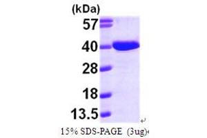 SDS-PAGE (SDS) image for Aminoadipate-Semialdehyde Dehydrogenase-phosphopantetheinyl Transferase (AASDHPPT) (AA 14-309) protein (His tag) (ABIN667231) (AASDHPPT Protein (AA 14-309) (His tag))