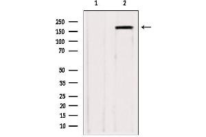 Western blot analysis of extracts from various samples, using ZCCHC11 antibody. (ZCCHC11 anticorps  (Internal Region))