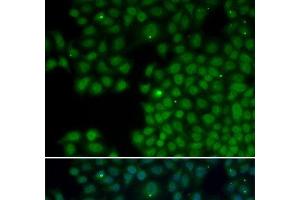Immunofluorescence analysis of HeLa cells using NUDT6 Polyclonal Antibody (NUDT6 anticorps)
