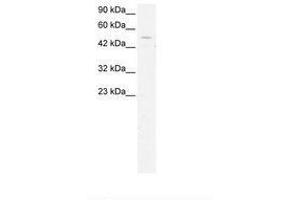 Image no. 3 for anti-General Transcription Factor IIH, Polypeptide 1, 62kDa (GTF2H1) (N-Term) antibody (ABIN202744)