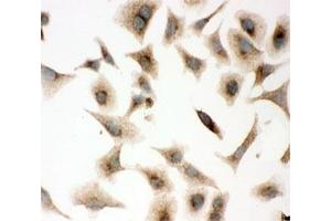 ICC testing of A549 cells with Caveolin-1 antibody.