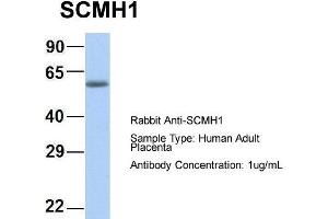Host: Rabbit Target Name: CHAD Sample Type: Human Adult Placenta Antibody Dilution: 1. (SCMH1 anticorps  (Middle Region))