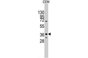 Western blot analysis of PITX2 polyclonal antibody  in CEM cell line lysates (35 ug/lane). (PITX2 anticorps  (C-Term))