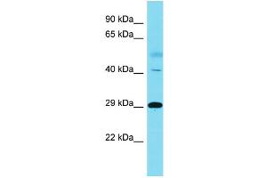 Host:  Rabbit  Target Name:  RNF149  Sample Type:  Lung Tumor lysates  Antibody Dilution:  1. (RNF149 anticorps  (C-Term))