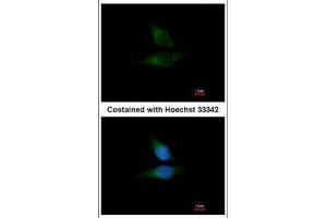 ICC/IF Image Immunofluorescence analysis of methanol-fixed HeLa, using ORP1, antibody at 1:200 dilution. (OSBPL1A anticorps  (C-Term))