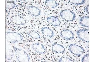 Image no. 2 for anti-Glial Fibrillary Acidic Protein (GFAP) antibody (ABIN1498436) (GFAP anticorps)