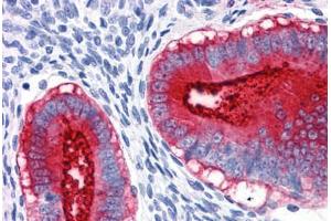 Uterus, Human: Formalin-Fixed, Paraffin-Embedded (FFPE)