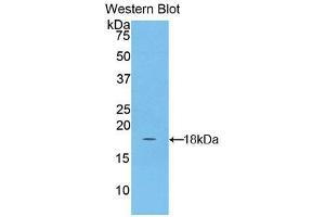 Detection of Recombinant ACP, Human using Polyclonal Antibody to Acyl Carrier Protein, Mitochondrial (ACP) (NDUFAB1 anticorps  (AA 5-129))