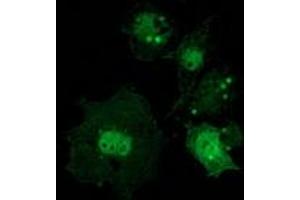 Anti-CTNNB1 mouse monoclonal antibody (ABIN2454167) immunofluorescent staining of COS7 cells transiently transfected by pCMV6-ENTRY CTNNB1 (RC208947). (CTNNB1 anticorps)