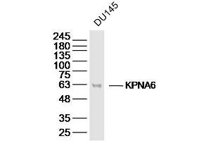 DU145 lysates probed with KPNA6 Polyclonal Antibody, Unconjugated  at 1:300 dilution and 4˚C overnight incubation. (KPNA6 anticorps  (AA 101-200))