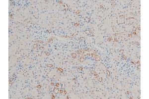 ABIN6267443 at 1/100 staining rat kidney tissue sections by IHC-P.