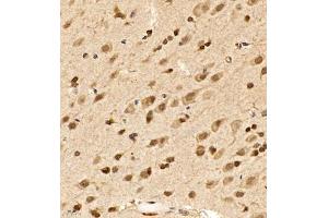Immunohistochemistry of paraffin embedded rat brain using SHF-1 (ABIN7075710) at dilution of 1:600 (400x lens)