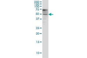 SMOC1 monoclonal antibody (M03), clone 8F10 Western Blot analysis of SMOC1 expression in A-431 .