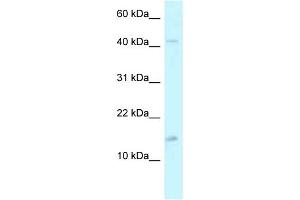 WB Suggested Anti-PCBD2 Antibody Titration: 1. (PCBD2 anticorps  (C-Term))