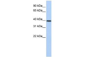 TIA1 antibody used at 1 ug/ml to detect target protein. (TIA1 anticorps  (N-Term))