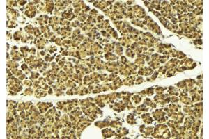 ABIN6274105 at 1/100 staining Mouse pancreas tissue by IHC-P. (AKAP8 anticorps  (Internal Region))