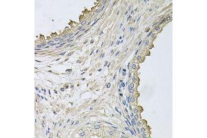 Immunohistochemistry of paraffin-embedded human prostate using HERC3 antibody (ABIN5996324) at dilution of 1/100 (40x lens).