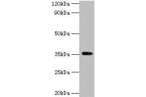 Western blot All lanes: DOK5 antibody at 2 μg/mL + Mouse kidney tissue Secondary Goat polyclonal to rabbit IgG at 1/15000 dilution Predicted band size: 36, 23 kDa Observed band size: 36 kDa