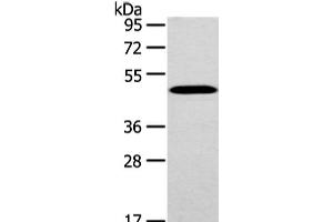 Western Blot analysis of Mouse brain tissue using WWOX Polyclonal Antibody at dilution of 1/200 (WWOX anticorps)