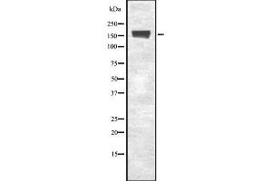 Western blot analysis of EEA1 using Jurkat whole cell lysates (EEA1 anticorps  (Internal Region))