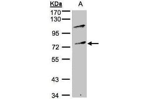 WB Image Sample(30 ug whole cell lysate) A:Raji , 10% SDS PAGE antibody diluted at 1:500 (MZF1 anticorps)