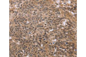 Immunohistochemistry (IHC) image for anti-Excision Repair Cross-Complementing Rodent Repair Deficiency, Complementation Group 6-Like (ERCC6L) antibody (ABIN2430026) (ERCC6L anticorps)