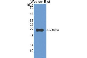 Western Blotting (WB) image for anti-Carbonic Anhydrase VA (CA5A) (AA 7-179) antibody (ABIN1175974)