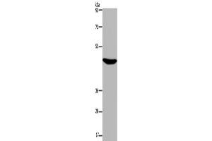 Western Blotting (WB) image for anti-Purinergic Receptor P2X, Ligand Gated Ion Channel 2 (P2RX2) antibody (ABIN2435128)