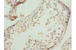 Immunohistochemistry of paraffin-embedded human testis tissue using ABIN7161136 at dilution of 1:100 (UBA3 anticorps  (Catalytic Subunit))